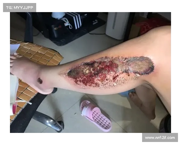 沿海休闲长道突变阶梯致骑行者严重摔伤面部大面积擦伤多处骨折 沿海休闲长道突变阶梯致骑行者严重摔伤面部大面积擦伤多处骨折